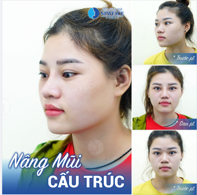 Nghe thiên hạ đồn tâm sinh tướng. Dạo này hết bướng nên trông cũng dịu hiền