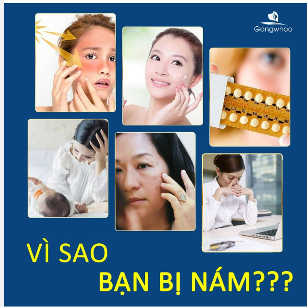 NGUYÊN NHÂN GÂY RA NÁM VÀ TÀN NHANG