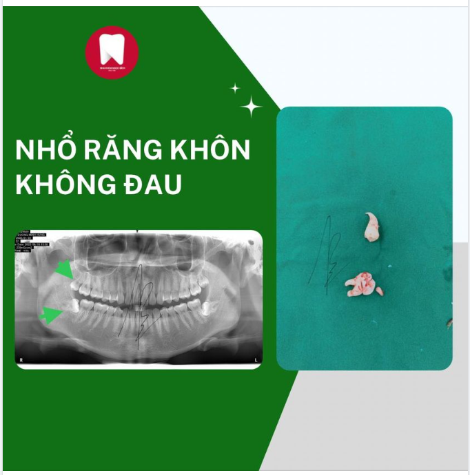 Nha khoa Ngọc Bích - Địa chỉ làm răng uy tín với hơn 20 năm kinh nghiệm trong lĩnh vực tạo hình, thẩm mỹ răng.