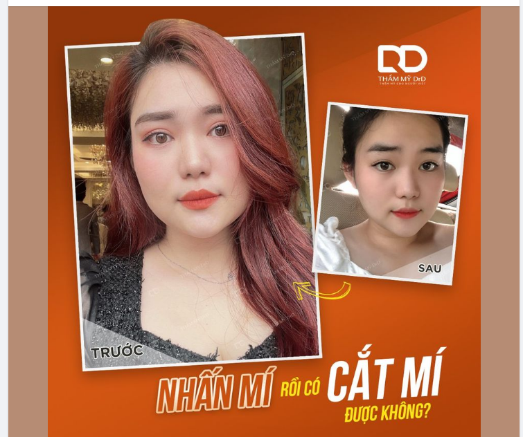 NHẤN MÍ RỒI CÓ CẮT MÍ ĐƯỢC KHÔNG