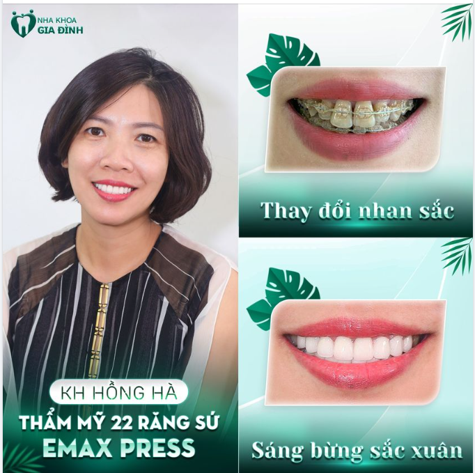 NHAN SẮC THAY ĐỔI NGOẠN MỤC CHỈ SAU 2 NGÀY