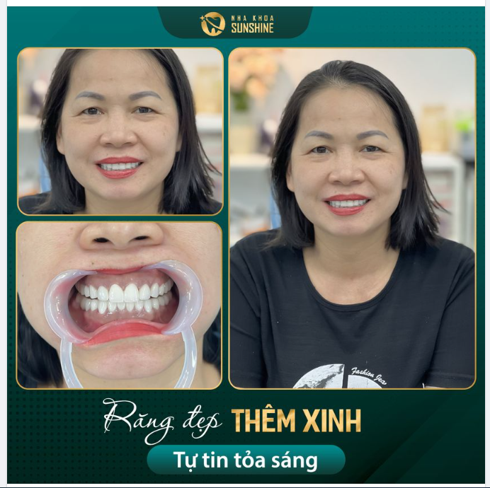 Nhanh chóng, An toàn chỉ sau 48H sở hữu nụ cười hài lòng nhất.
