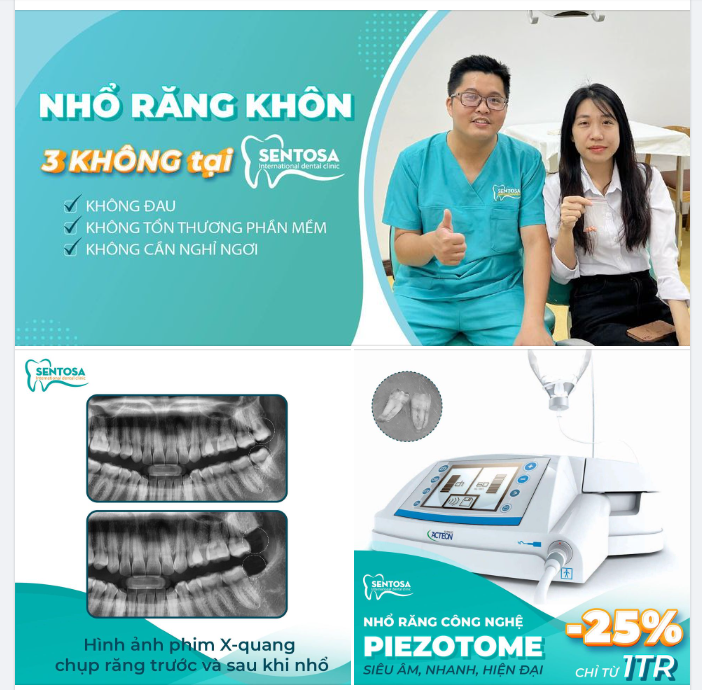 Nhẹ nhàng loại bỏ "răng khôn phiền phức"