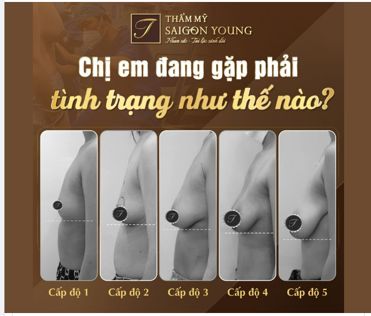 Nhiều chị em vẫn còn nghĩ rằng, vòng 1 của mọi người đều giống nhau. Vì vậy vẫn có nhiều chị em hay so sánh V1 của mình và những chị em khác.