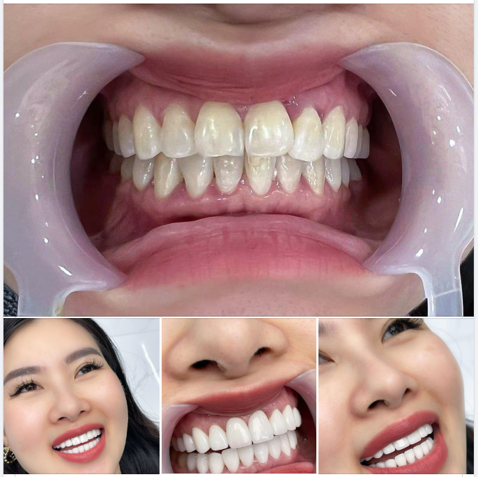 Nhiều khách hàng đến với Delia không chỉ vì thẩm mỹ mà còn để là do các bệnh lý răng miệng.