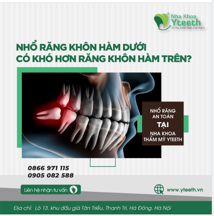 NHỔ RĂNG KHÔN HÀM DƯỚI CÓ KHÓ HƠN RĂNG KHÔN HÀM TRÊN?