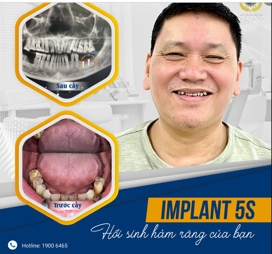 "NHƯ ĐƯỢC HỒI SINH VẬY
