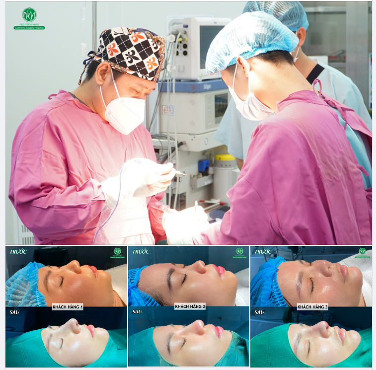 NHỮNG KẾT QUẢ ĐẸP TIÊU BIỂU SAU NÂNG MŨI