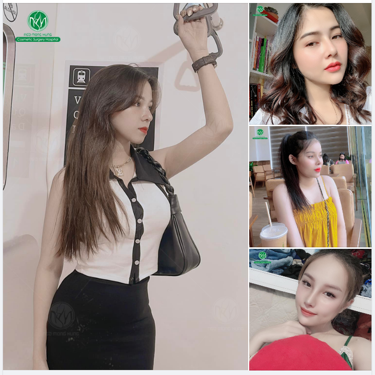 NHỮNG KHÁCH HÀNG XINH ĐẸP VỚI DÁNG MŨI S LINE