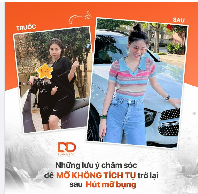 NHỮNG LƯU Ý CHĂM SÓC SAU HÚT MỠ ĐỂ MỠ KHÔNG TÍCH TỤ TRỞ LẠI