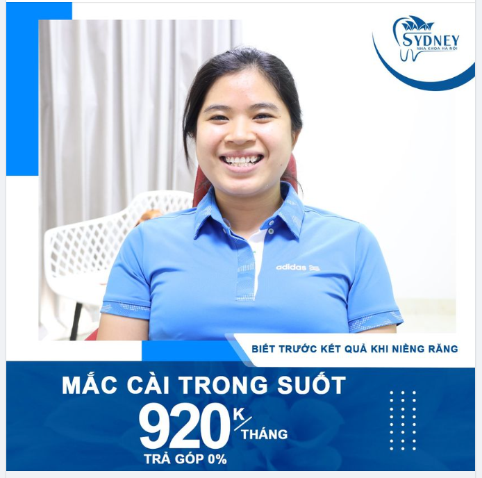 NHỮNG LƯU Ý KHI NIỀNG RĂNG CÓ THỂ BẠN CHƯA BIẾT