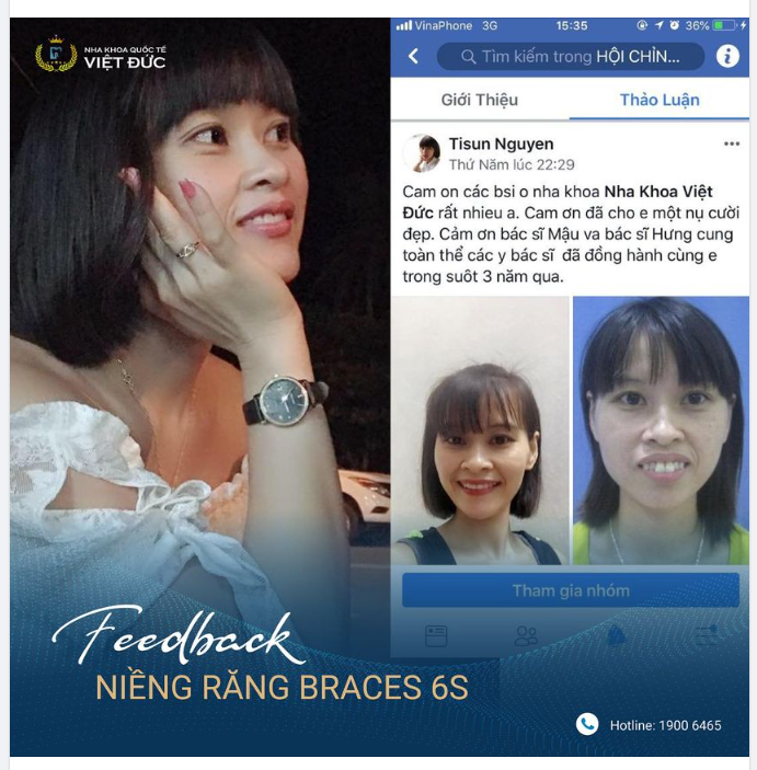 NIỀNG RĂNG, BẠN SẼ ĐẸP THẾ NÀO?