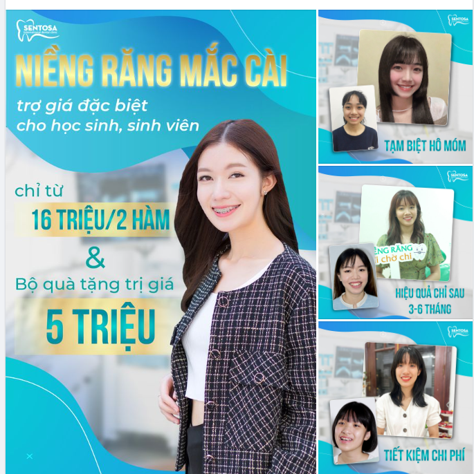 NIỀNG RĂNG HÔM NAY -NHẬN NGAY QUÀ XỊN