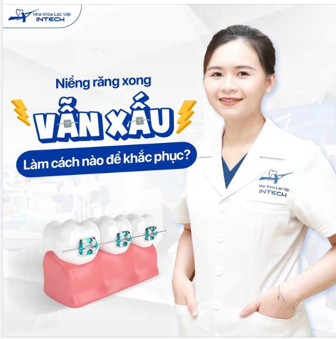 NIỀNG RĂNG XONG VẪN XẤU, LÀM CÁCH NÀO ĐỂ KHẮC PHỤC?