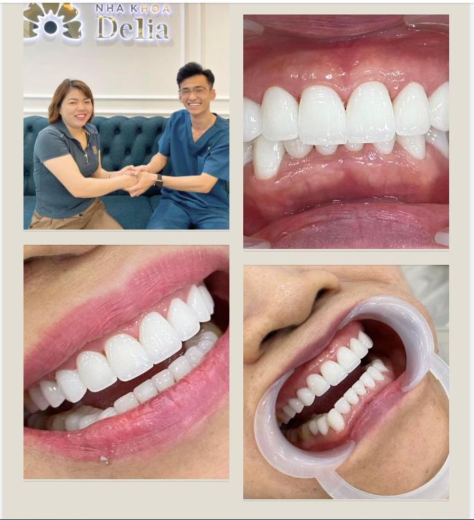 Nụ cười an toàn, khỏe mạnh và hạnh phúc chính là thước đo cho tình yêu mà Delia đã, đang và sẽ nhận được ngày càng nhiều từ các khách hàng tin tưởng lựa chọn!