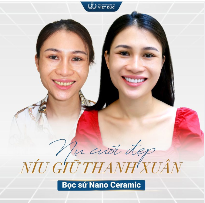 NỤ CƯỜI ĐẸP - CHÌA KHÓA NÍU GIỮ THANH XUÂN