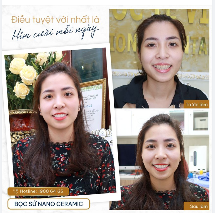 NỤ CƯỜI ĐẸP NHẤT LÀ NỤ CƯỜI TỰ TIN