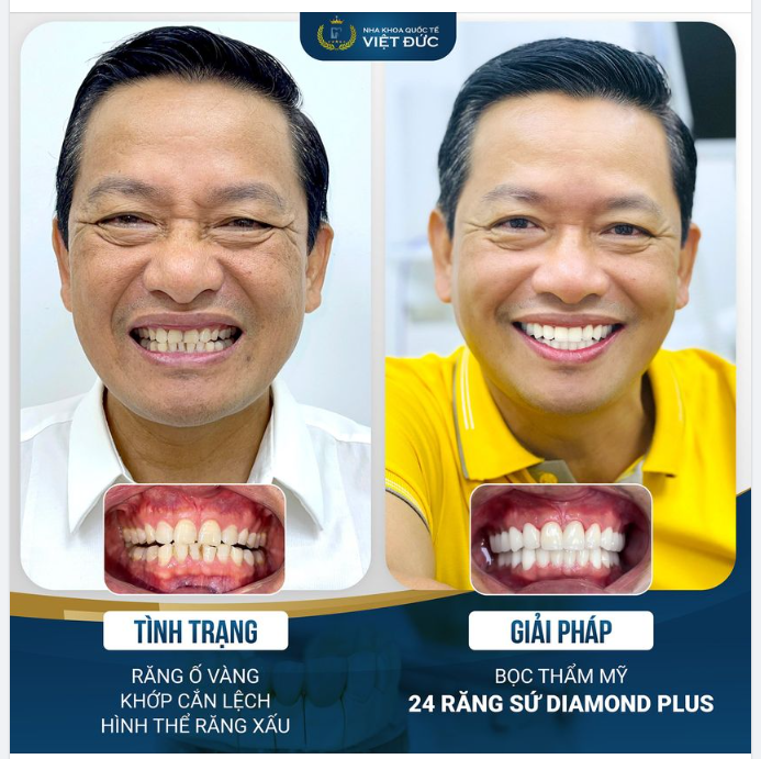 NỤ CƯỜI LỊCH LÃM, FORM RĂNG MẠNH MẼ - BÍ QUYẾT THÀNH CÔNG CỦA NGƯỜI ĐÀN ÔNG HIỆN ĐẠI