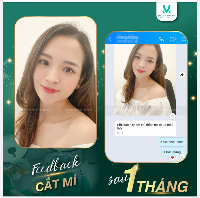 Ở đây có nếp mí xinh 1 tháng tuổi
