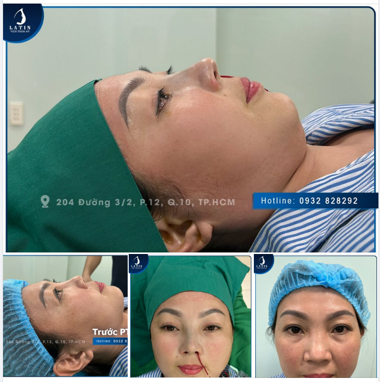 Ở tuổi trung niên có nên làm đẹp