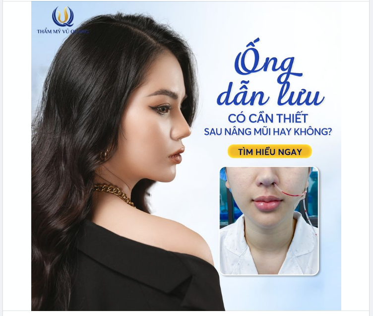 Ống dẫn lưu có cần thiết sau nâng mũi hay không