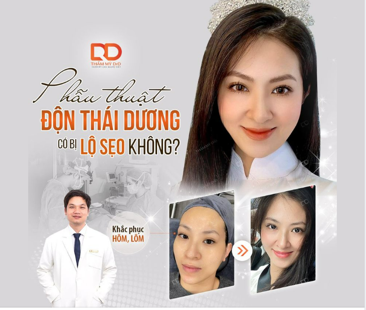 PHẪU THUẬT ĐỘN THÁI DƯƠNG CÓ LỘ SẸO KHÔNG
