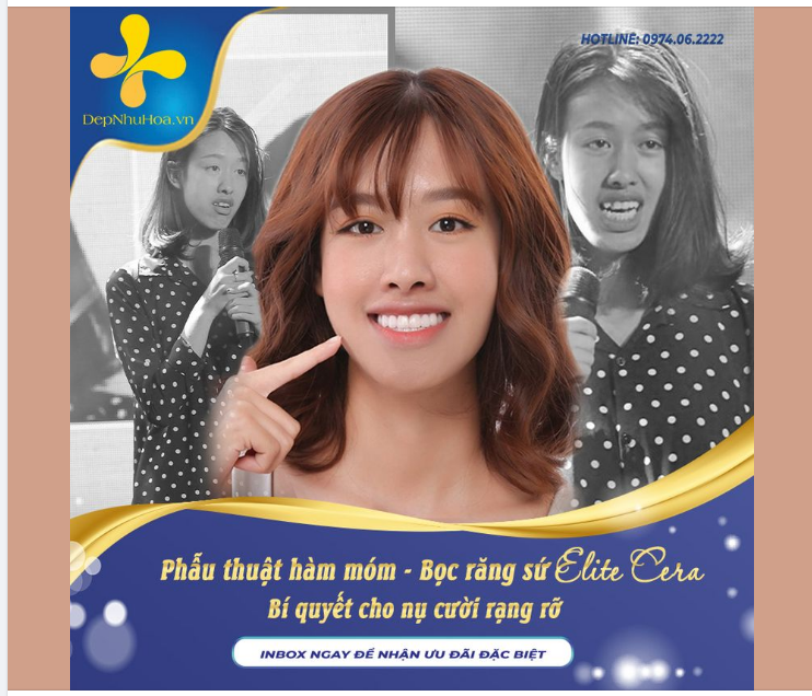 PHẪU THUẬT HÀM MÓM  BỌC RĂNG SỨ ELITE CERA - BÍ QUYẾT CHO NỤ CƯỜI RẠNG RỠ