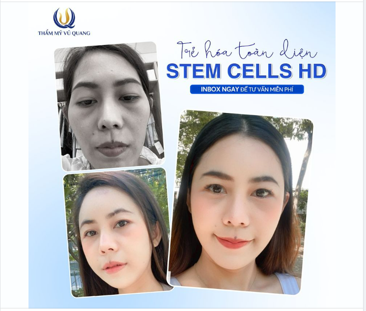 Phép màu cho khuôn mặt hốc hác, già nua Trẻ hoá toàn diện Stem Cells HD - Đưa bạn về thanh xuân