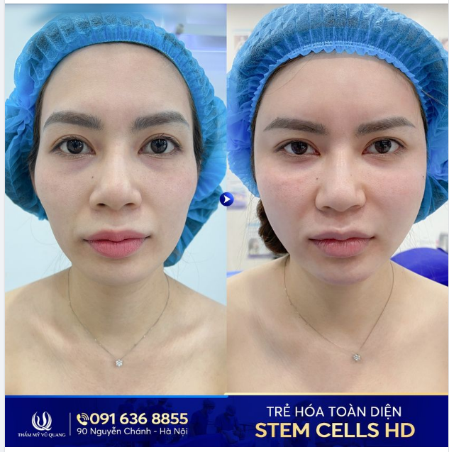 Phụ nữ chẳng sợ gì, chỉ sợ già