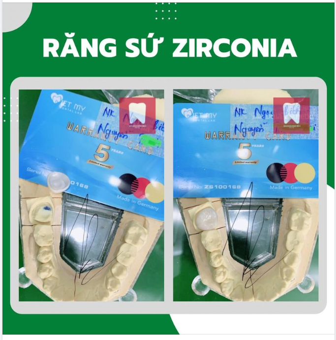 PHỤC HÌNH THẨM MỸ RĂNG SỨ ZIRCONIA