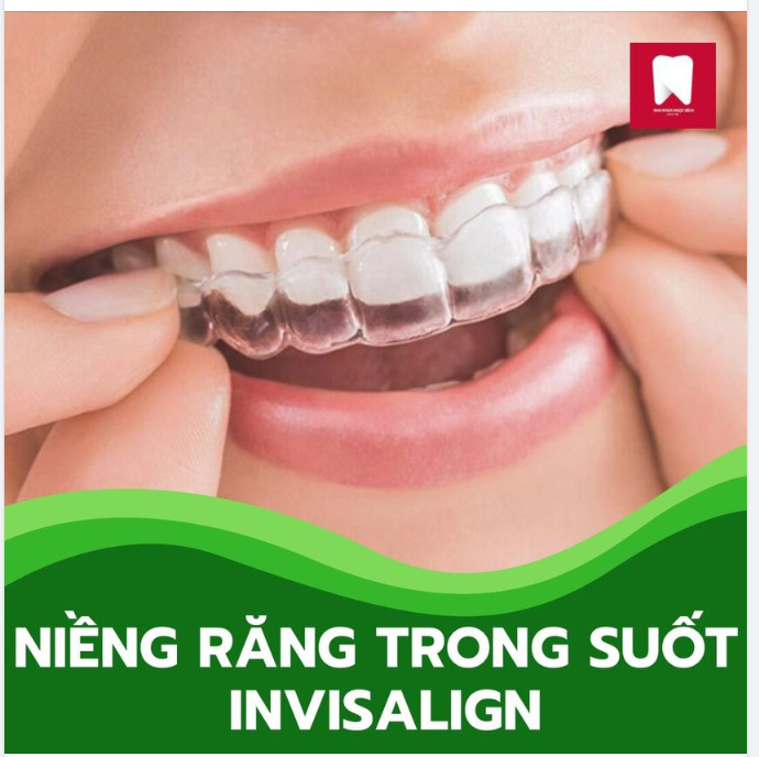 Phương pháp niềng răng trong suốt Invisalign