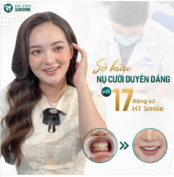 Phương pháp thẩm mỹ không dao kéo, chỉ sau 48H sở hữu nụ cười như ý.