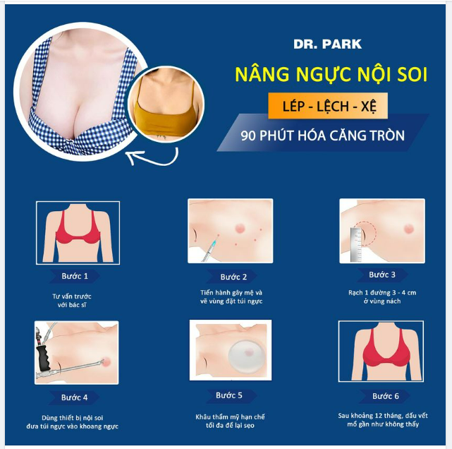 QUY TRÌNH NÂNG NGỰC NỘI SOI ĐƯỜNG NÁCH