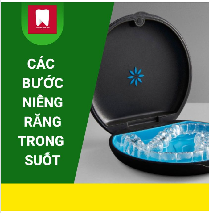 QUY TRÌNH NIỀNG RĂNG TRONG SUỐT INVISALIGN 