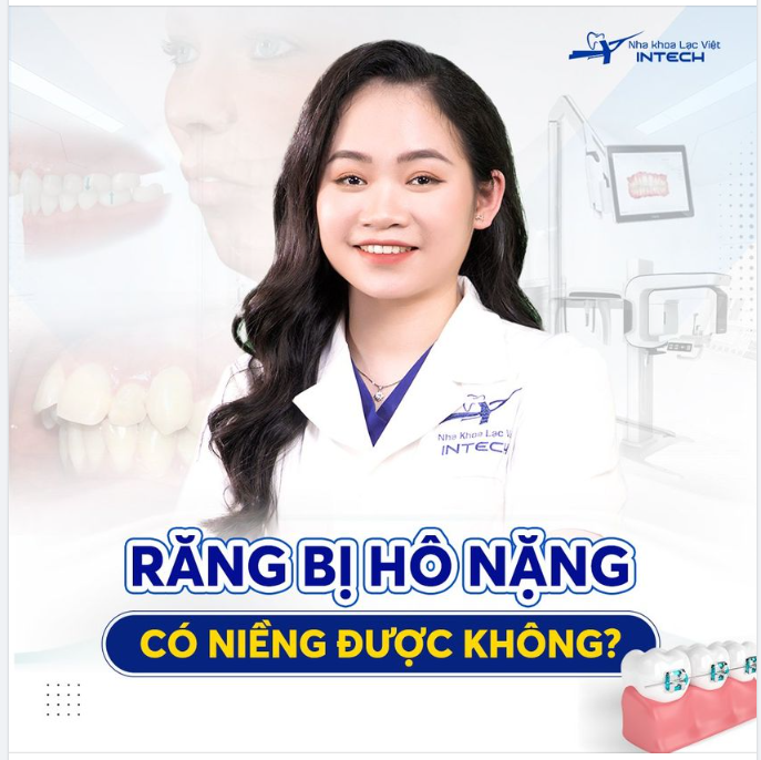 RĂNG BỊ HÔ NẶNG CÓ NIỀNG ĐƯỢC KHÔNG?