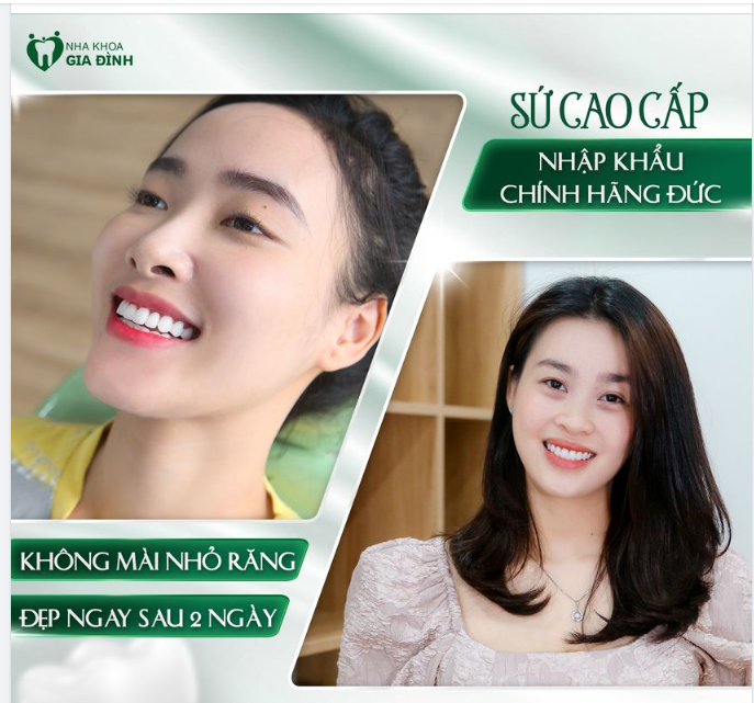RĂNG ĐẸP THẾ NÀY TẠI SAO BẠN CÒN CHƯA LÀM?