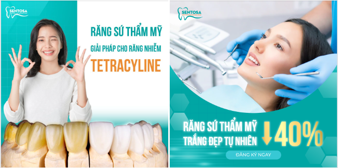 GIẢI PHÁP NÀO CHO RĂNG NHIỄM KHÁNG SINH TETRACYCLINE?