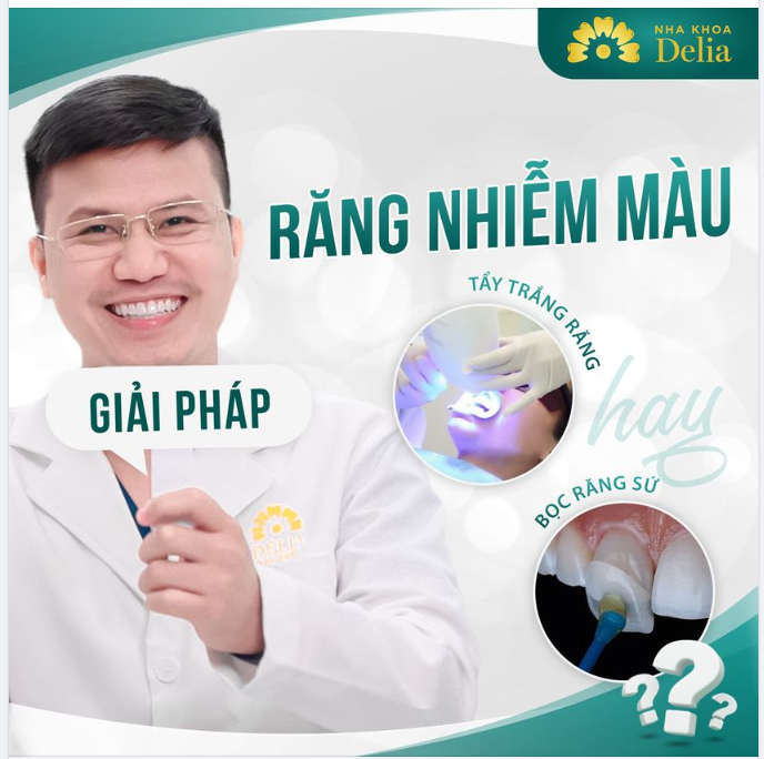 Răng nhiễm màu, ố vàng - Đâu là giải pháp tối ưu nhất