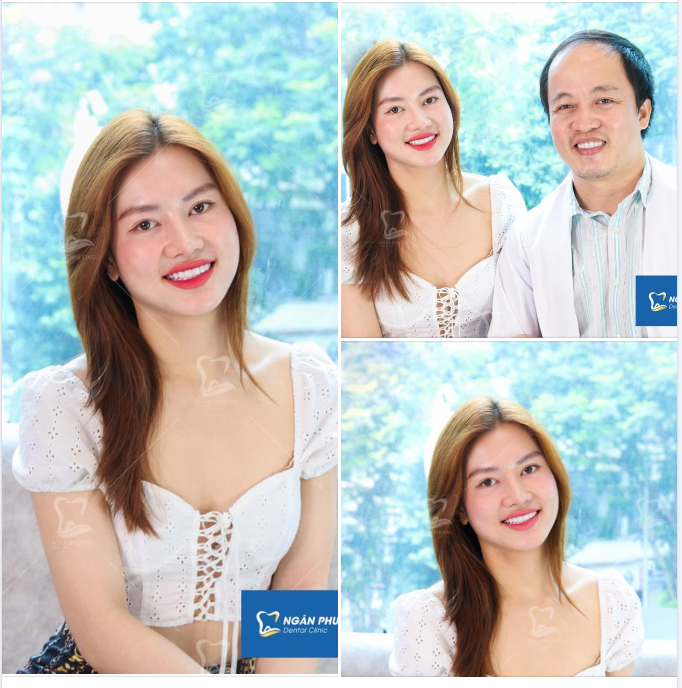Răng sứ đẹp xinh như ngày đầu có khiến chị em mê mẩn