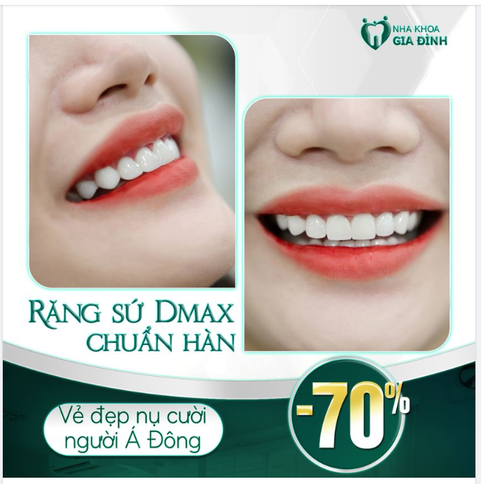RĂNG SỨ DMAX -  VẺ ĐẸP TRONG SÁNG CỦA NGƯỜI PHỤ NỮ Á ĐÔNG