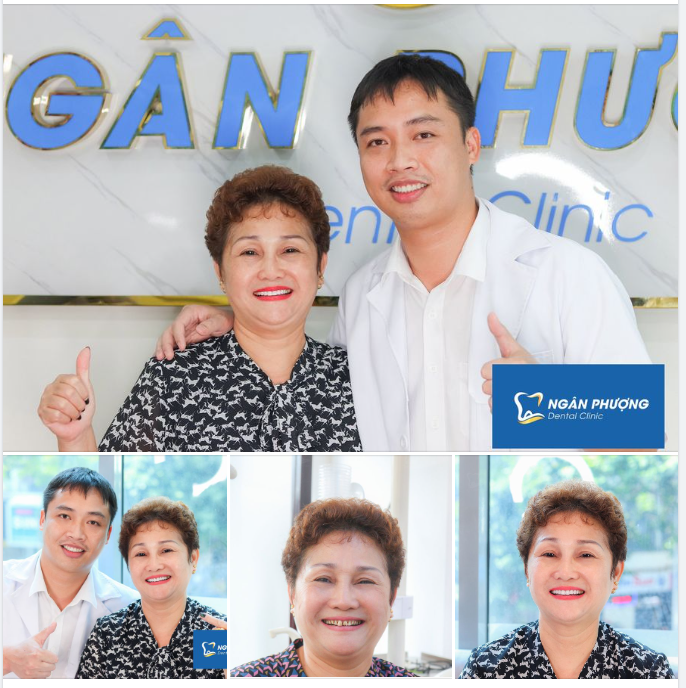 Răng sứ thẩm mỹ tái tạo nụ cười không tuổi