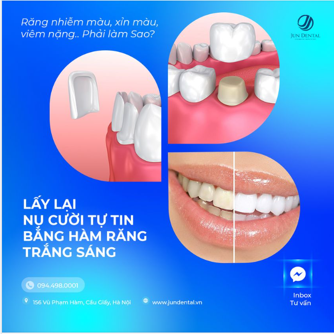 RĂNG VÀNG Ố MUỐN RĂNG TRẮNG THÌ LÀM SAO?