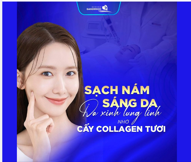 Cấy collagen tươi có skinfood?
