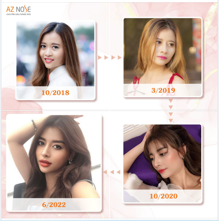 Sở hữu dáng mũi cao xinh, tự tin cân mọi phong cách