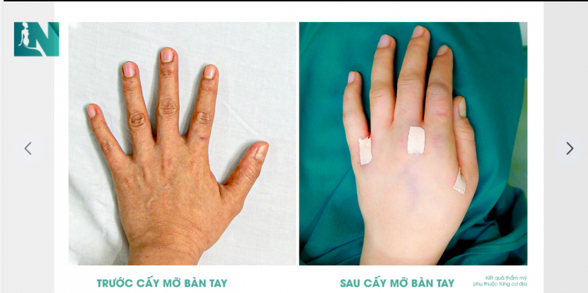 SỞ HỮU ĐÔI TAY MỀM MẠI, MỊN MÀNG – ĐÂU NỠ CHỐI TỪ!