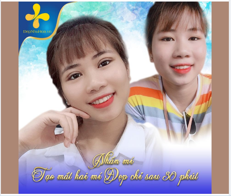 Sở hữu ngay đôi mắt TO TRÒN - RÕ NẾP MÍ với phương pháp NHẤN MÍ.