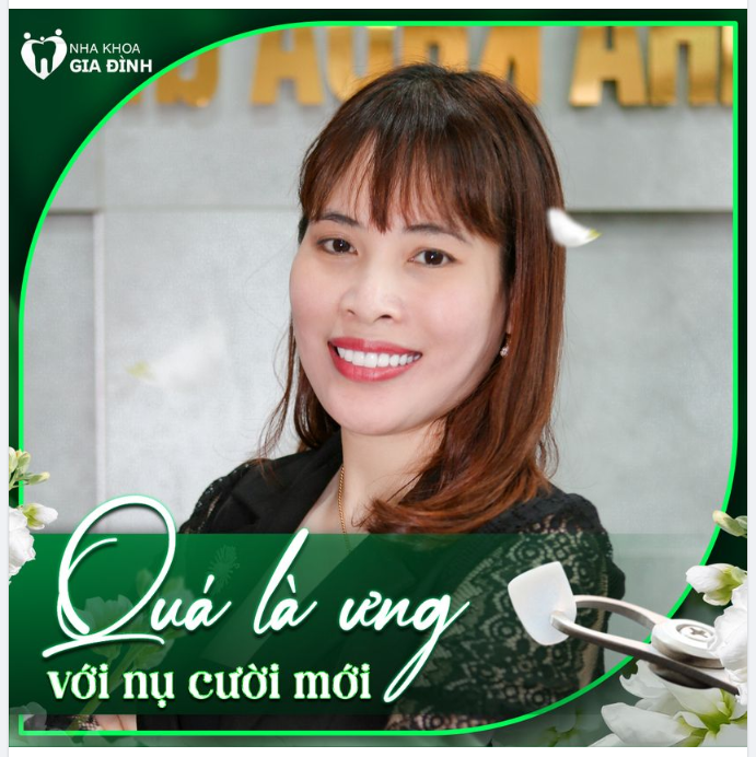 SỞ HỮU NỤ CƯỜI MỚI QUÁ LÀ ƯNG LUÔN!!!