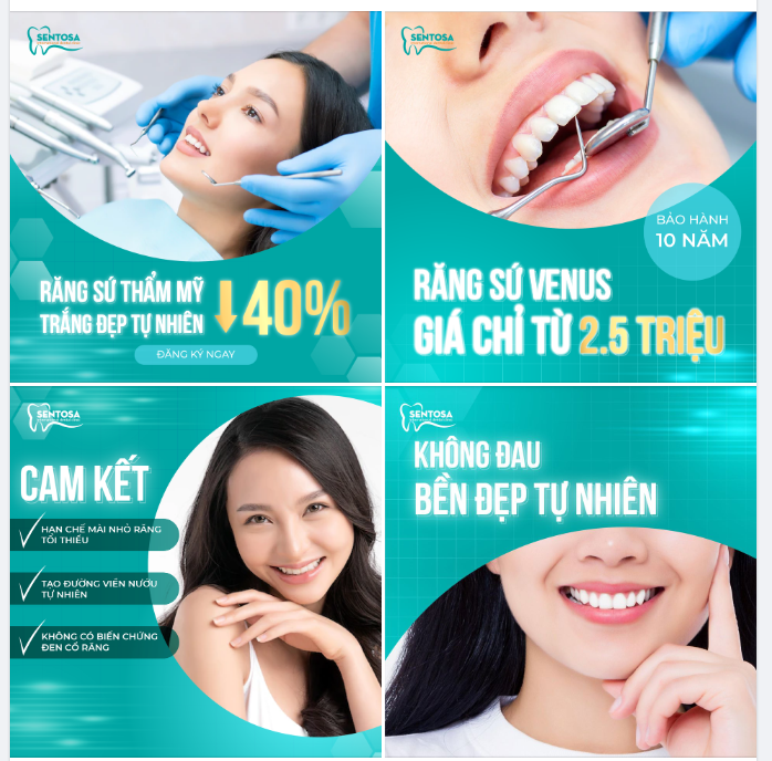 SỞ HỮU RĂNG SỨ THẨM MỸ ĐẸP RẠNG NGỜI