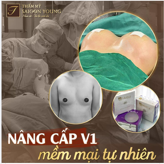 SỰ LỰA CHỌN HOÀN HẢO
