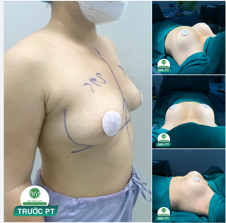 SỰ LỰA CHỌN HOÀN HẢO